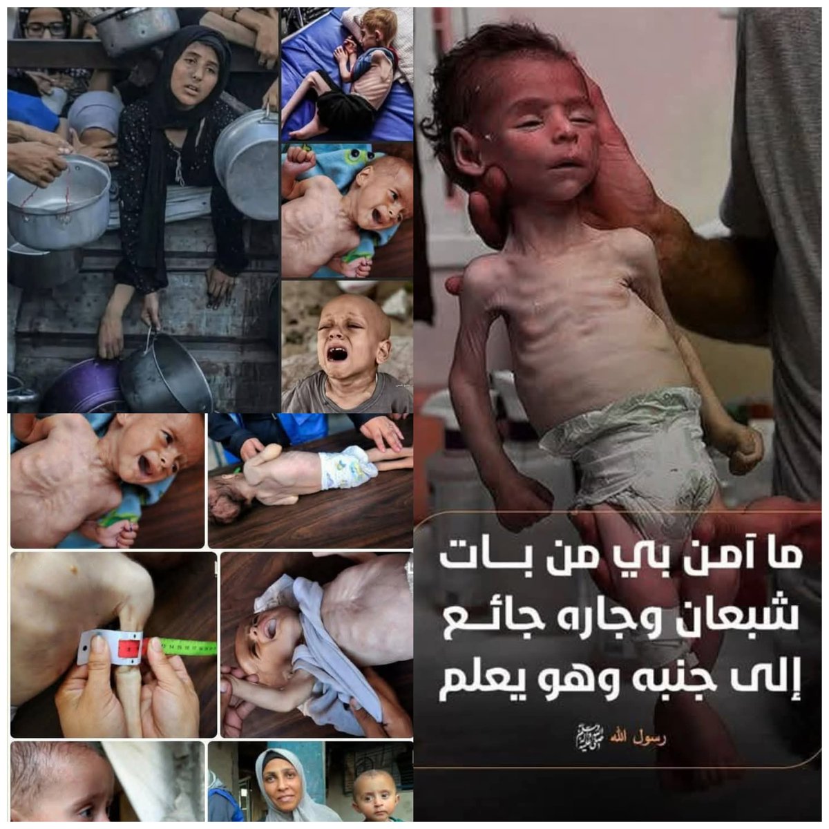 🚨 |  غـ..زة تمــوت جوعًا ، مناظر تبكي القلب قبل العين حسبنا الله