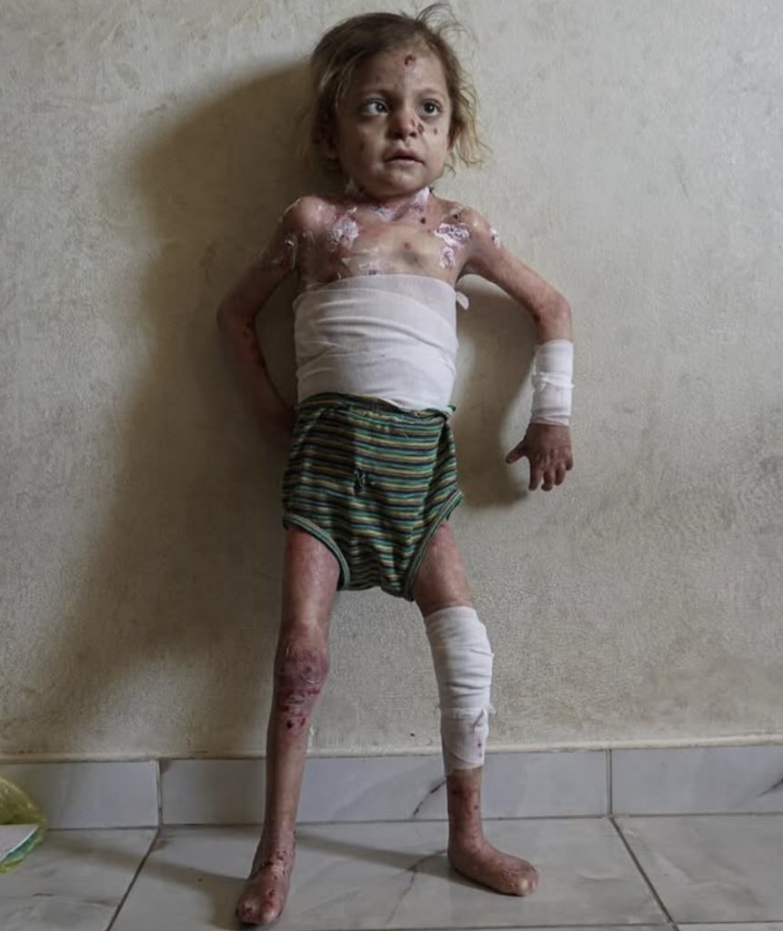 Look at this little angel girl, she is starving 💔

If you see this pic, reply with 🇵🇸 💔