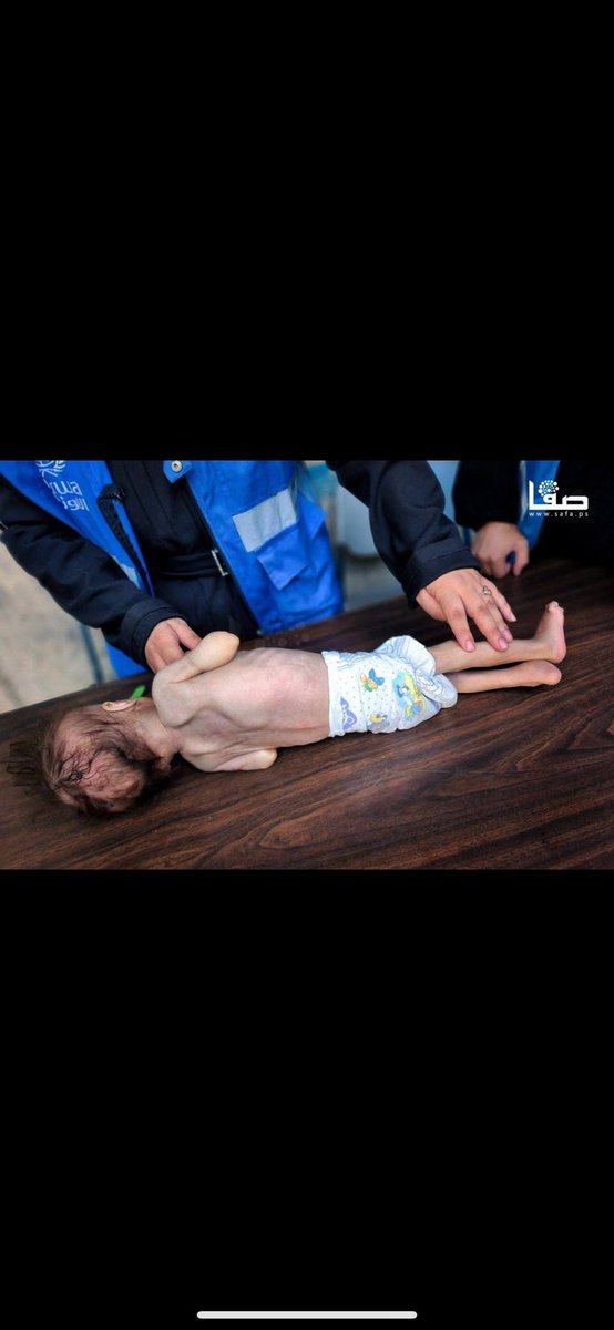 SpeakWithDeeDee's tweet image. ISRAEL IS STARVING BABIES‼️
Authorities in Gaza warned on 20 July that the strip is “on the brink of mass death” due to widespread famine and starvation resulting from Israel’s siege and genocidal war.
“We are on the brink of mass death due to the Israeli occupation's closure…