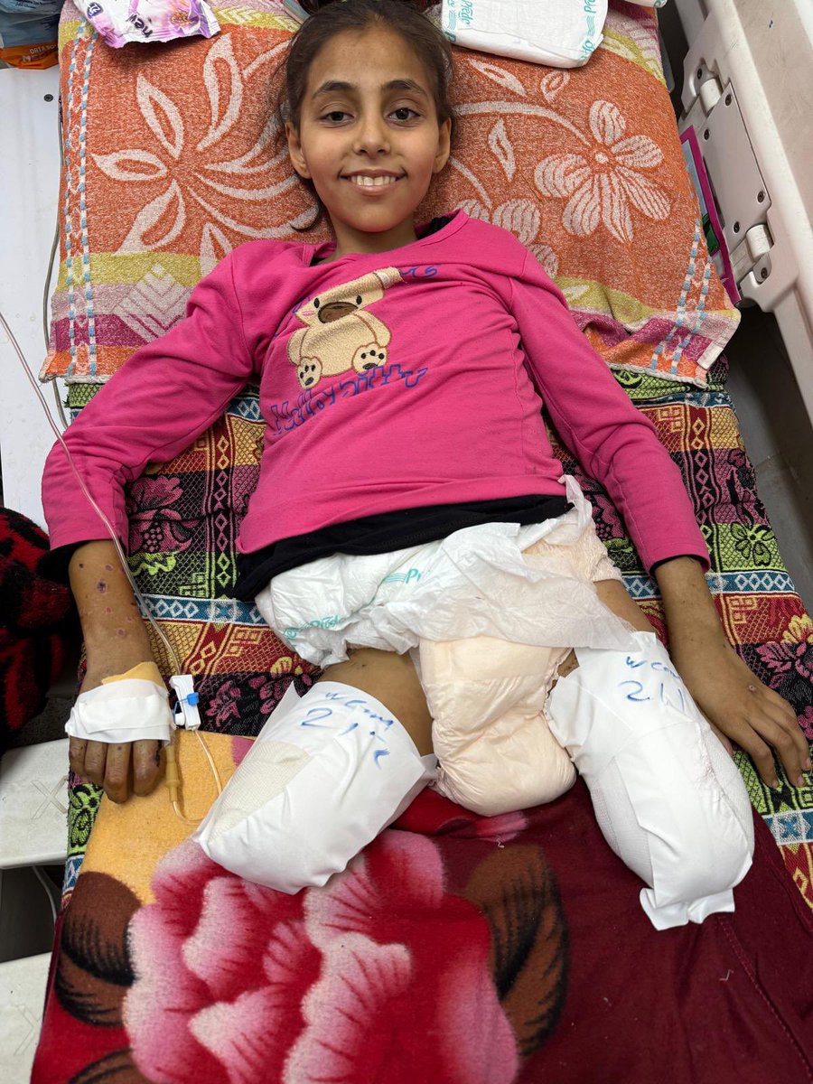 Stevesosebee's tweet image. Save a life and you save all of mankind. Seba, 12, was displaced with her family from their refugee camp when on January 4, 2025, while sheltering in a tent, an Israeli airstrike nearly killed her. She lost both legs. Tragically, Seba’s father had already been killed in an…
