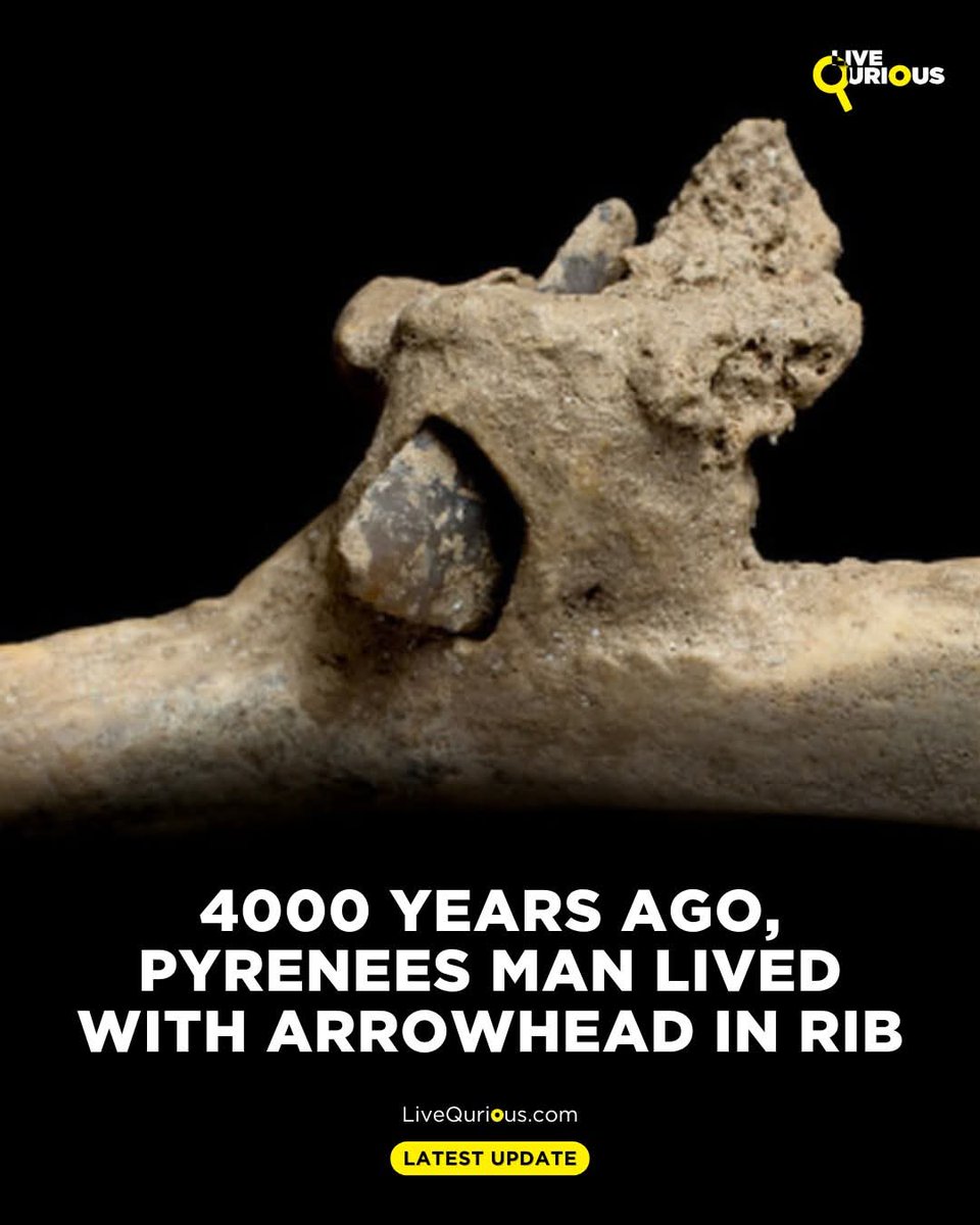 4biddnKnowledge's tweet image. High in the Pyrenees, archaeologists have uncovered a human rib that tells a chilling story of survival and violence from more than 4000 years ago. The rib, discovered in the Roc de les Orentes burial cave, still holds a flint arrowhead embedded within it, a permanent reminder of…