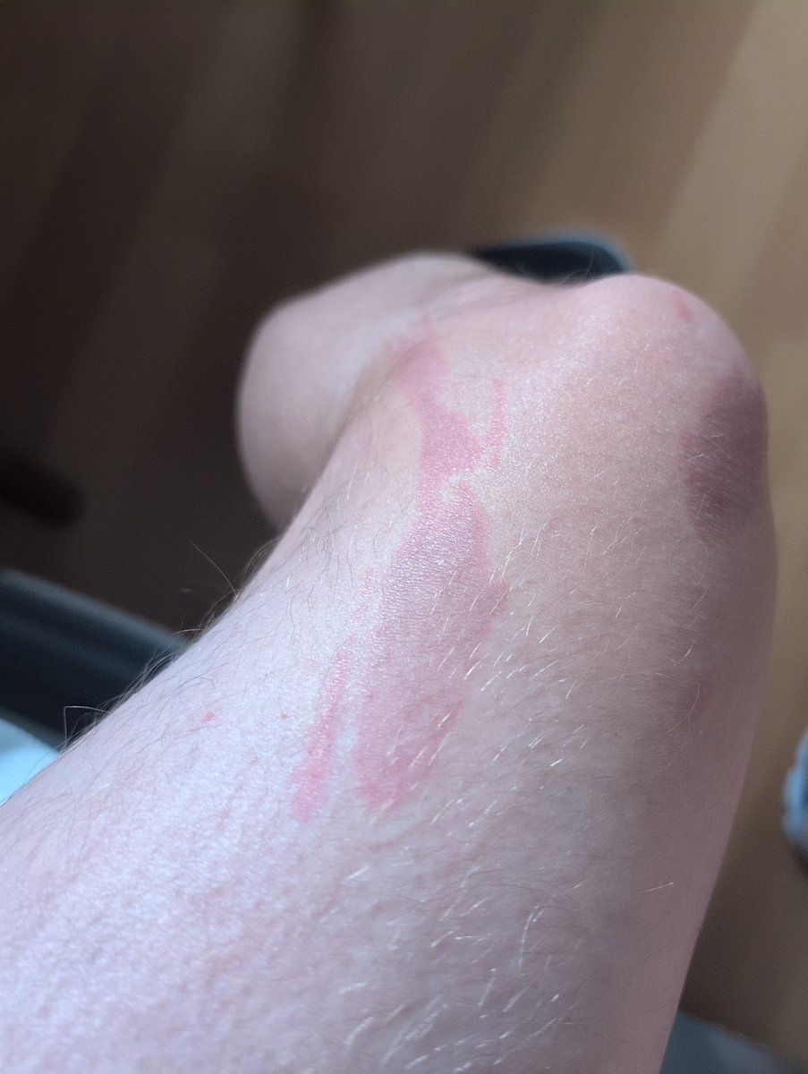 ASpooner85's tweet image. Okay. Den Kampf gegen das heiße Fett hab ich dann wohl verloren.