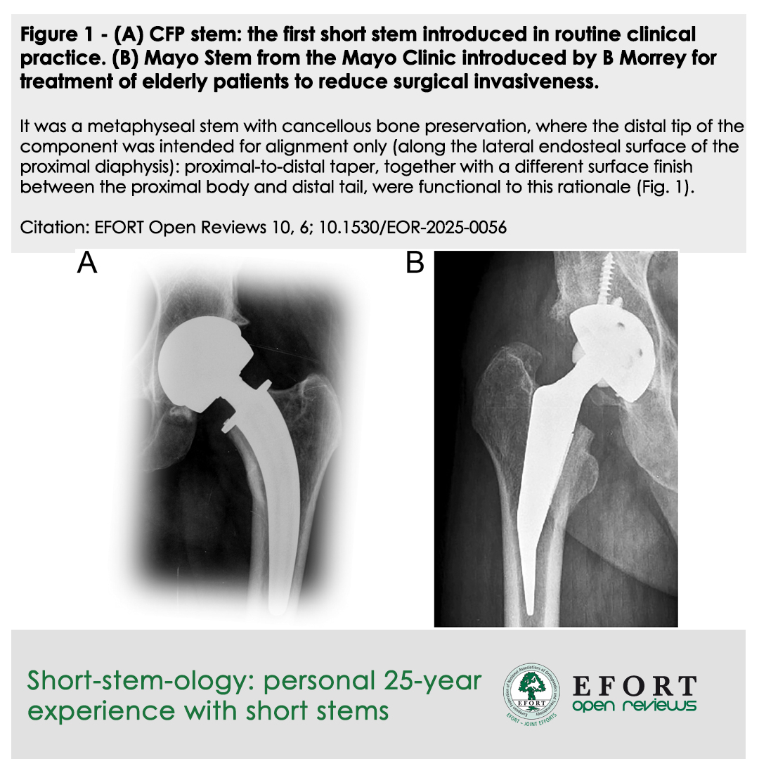 #EOR  Short-stem-ology – 25 years of experience with #ShortStems in #THA 🦵⏳
Despite scepticism, registries show excellent survival &amp; lower revision rates than std stems 📈
Key benefit: #BonePreservation 🦴
A strong primary option! 🔗bit.ly/EOR250606
#EFORT #StemCells