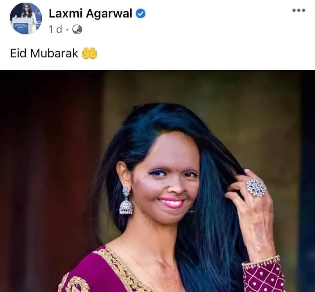Laxmi Agarwal was attacked with acid in 2005 by Naeem Khan when she was just 15