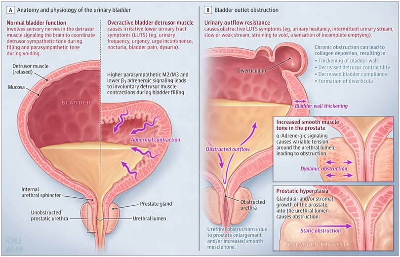 📚 LUTs pathophysiology!