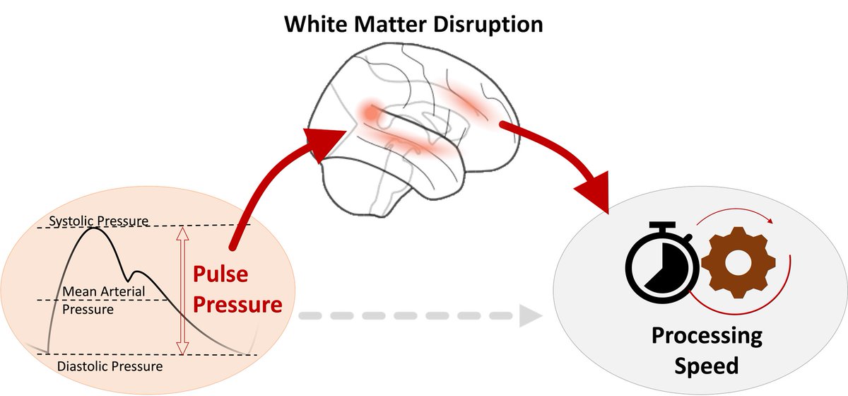 mrccbu's tweet image. Recent research from CamCAN shows that, when pulse pressure, the difference between systolic and diastolic blood pressure, gets too high, it can damage the brain’s “wiring” (white matter), making it harder to think fast and solve puzzles: doi.org/10.1161/HYPERT…