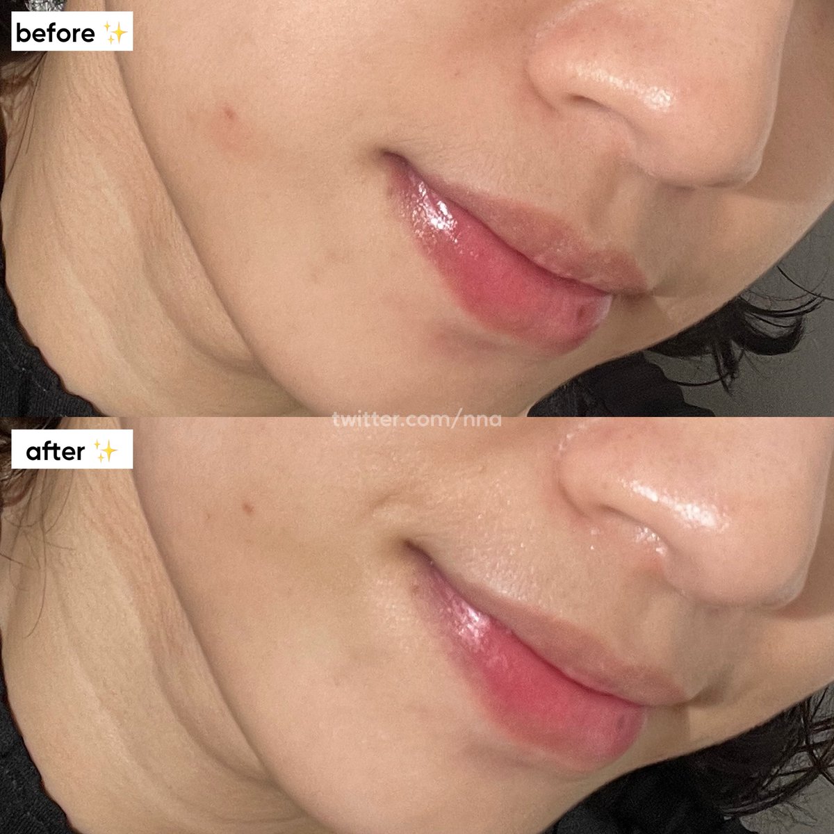nna's tweet image. ga nyangka, ternyata ingredients PDRN bisa jd kuncian aku klo kulit lg ada kemerahan 😱
klo temen2 kulitnya sensitive atau lg ngalamin iritasi, cobain PDRN linenya some by mi deh ✨ #racuninskincare