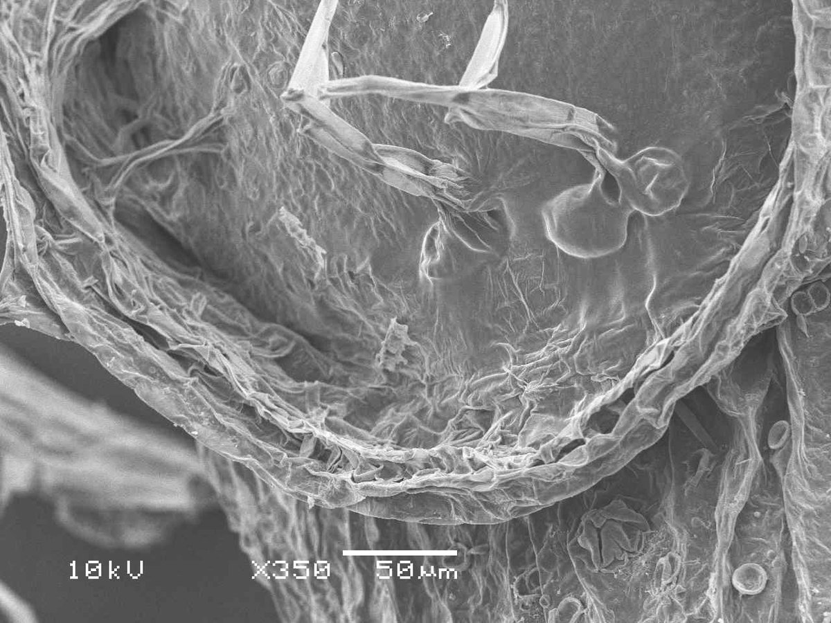 タヌキモの捕虫嚢の蓋は内開きするけど、常に捕虫嚢は水を抜いてスポイドでいうところの「つまんだ状態」になっているので、蓋は常に内側に引っ張られているからどうやってその力から逃げ、必要な時に開くのかわからなかったけど、パッキンみたいなのがありました。

さて、無事 展示とテキスト完成！