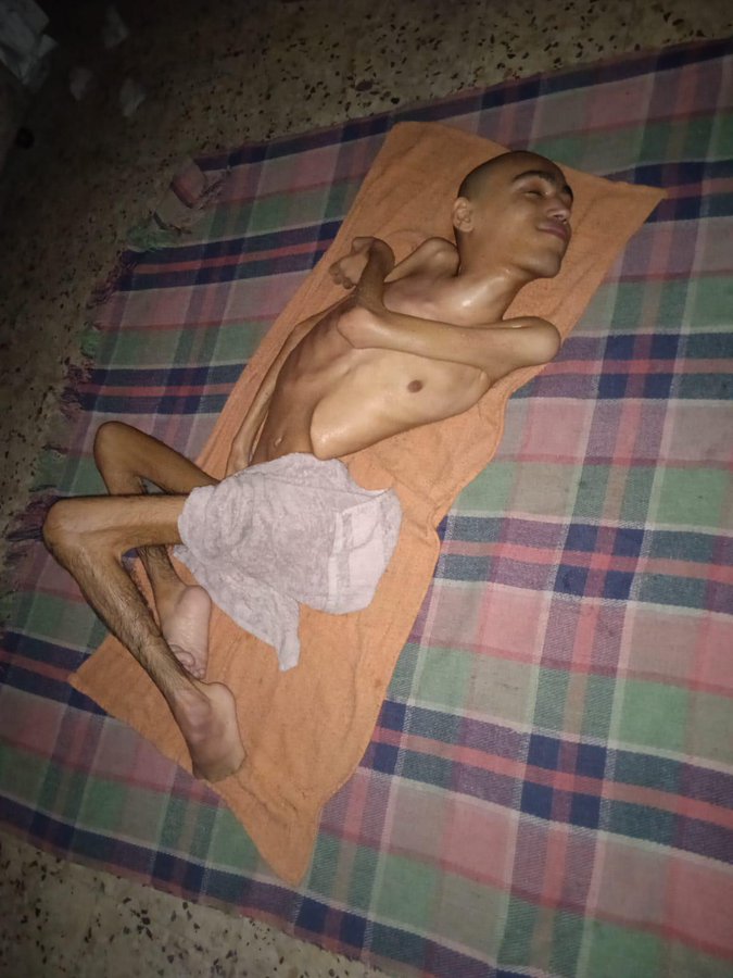 aaaaaaa512011's tweet image. #غزة_تموت_من_الجوع
#Gaza_is_dying_of_hunger #Gazzea_çlıktan_ölüyor
#Gaza_se_muerede_hambre
#Gaza_meurt_de_faim
#Газа_умирает_от_голода
#加沙正因饥饿而死
#ガザは飢餓で死にかけている
#가자는_굶주림으로_죽어가고_있다