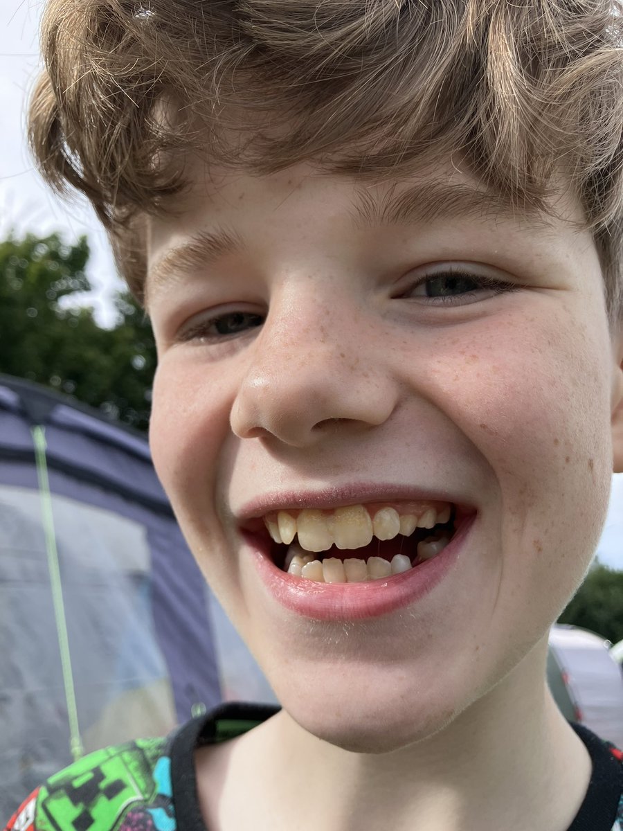 Does the tooth fairy come to a tent? Or to an eleven year old?