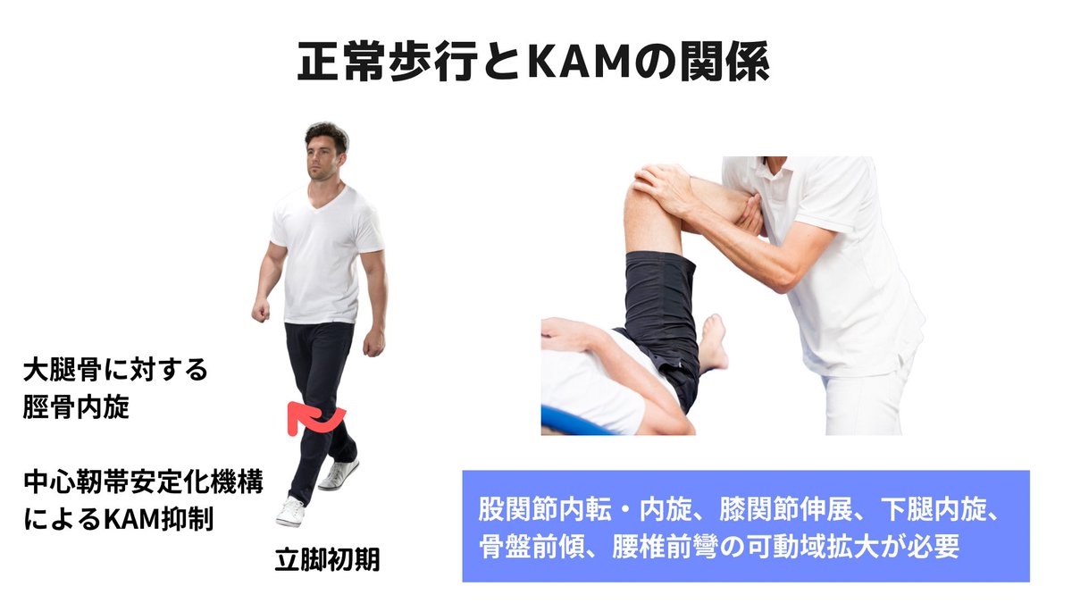 mongori37's tweet image. 膝OAの歩容といえば、外側スラスト(varus thrust)が特徴の一つです。

varus thrustはKAM(外部膝関節内反モーメント)と相関し、痛みとも相関があります。

KAMを抑制するためのポイントの1つが脛骨内旋による中心靱帯安定化機構。