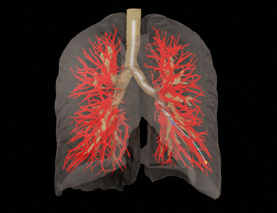 ScienceMagazine's tweet image. A new @SciRobotics Review discusses how #AI can guide needle-based robotic procedures for applications involving biopsies, drug delivery, and tumor ablations to improve medical outcomes. scim.ag/4nCYDGJ