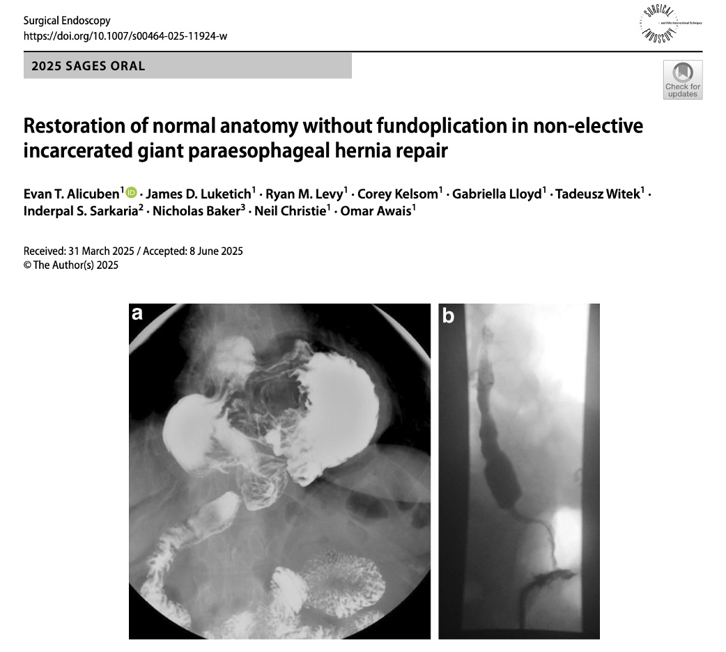 UPMC_CTSurgery's tweet image. Restoration of normal anatomy without fundoplication is a safe and effective option for patients presenting with giant paraesophageal hernia in non-elective settings
🔗: pubmed.ncbi.nlm.nih.gov/40659950/
@SAGES_Updates #SurgicalEndoscopy #GPEH #ParaesophagealHernia #HiatalHernia