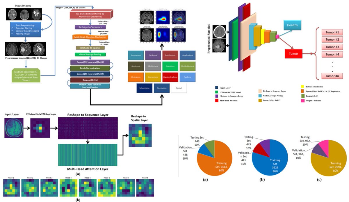 medntdj's tweet image. MBTC-Net: Multimodal brain tumor classification from CT and MRI scans using deep neural network with multi-head attention mechanism
doi.org/10.1016/j.medn…
#Multimodal brain tumor classification #EfficientNetv2b0
#MedTwitter #scicomm #MedEd #AcademicTwitter