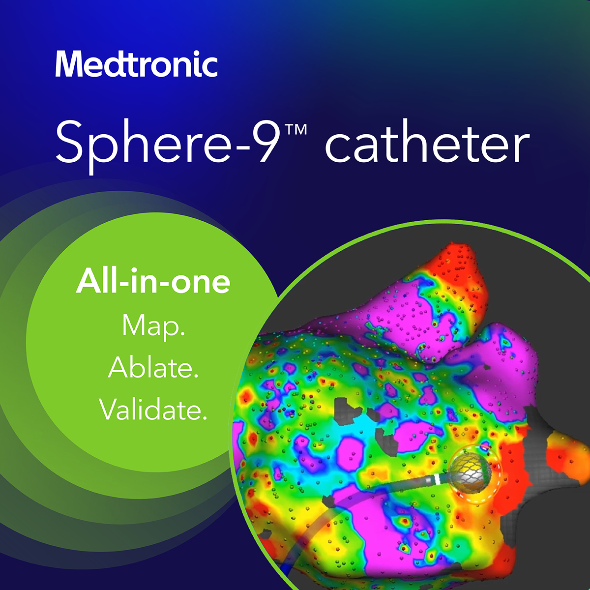 Map. Ablate. Validate — the Sphere-9™ catheter offers three key functions in one device, designed for an integrated experience exclusively for use with Affera™. #Epeeps #PFA #Affera

See risk info: bit.ly/4dQ9oRr
Learn more: bit.ly/4eGG3cr
