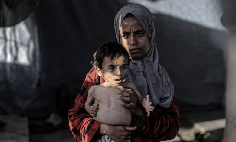 İsrail'in dört aydır insani yardım girişini engellediği Gazze Şeridi'nde sadece Pazar günü en az 18 Filistinli açlıktan öldü. (Quds News)