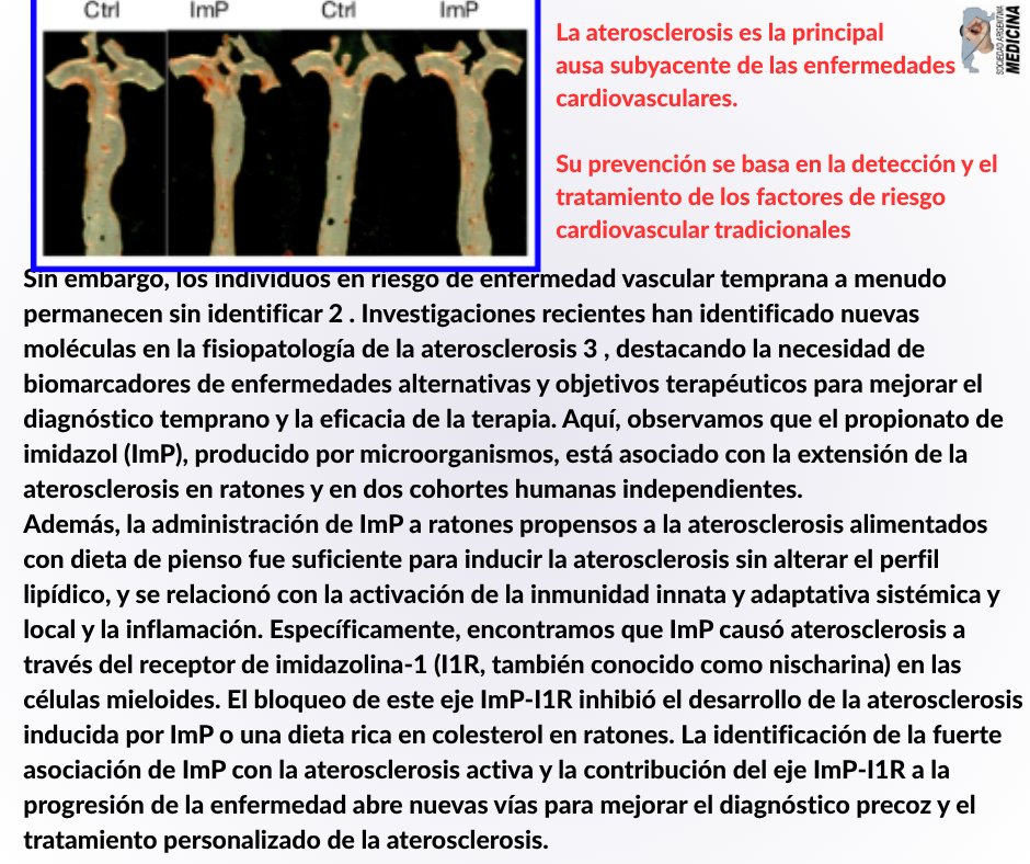 Sociedad Argentina de Medicina (SAM) (@medicinasam) on Twitter photo 💟𝐀𝐓𝐄𝐑𝐎𝐒𝐂𝐋𝐄𝐑𝐎𝐒𝐈𝐒: 𝐞𝐥 𝐩𝐫𝐨𝐩𝐢𝐨𝐧𝐚𝐭𝐨 𝐝𝐞 𝐢𝐦𝐢𝐝𝐚𝐳𝐨𝐥 𝐞𝐬 𝐮𝐧 𝐟𝐚𝐜𝐭𝐨𝐫 𝐢𝐦𝐩𝐮𝐥𝐬𝐨𝐫 𝐲 𝐮𝐧 𝐨𝐛𝐣𝐞𝐭𝐢𝐯𝐨 𝐭𝐞𝐫𝐚𝐩𝐞́𝐮𝐭𝐢𝐜𝐨 𝐧𝐮𝐞𝐯𝐨!!
▶️Five Trending topics en pubmed
🚩tinyurl.com/4kem52wv
<a href="/SOLATdifusion/">Sociedad LatinoAmericana Aterosclerosis</a> <a href="/Diabetes_SEMI/">GT-SEMI Diabetes, Obesidad y Nutrición #17DM_SEMI</a> <a href="/redGDPS/">redGDPS Diabetes</a> 💟𝐀𝐓𝐄𝐑𝐎𝐒𝐂𝐋𝐄𝐑𝐎𝐒𝐈𝐒: 𝐞𝐥 𝐩𝐫𝐨𝐩𝐢𝐨𝐧𝐚𝐭𝐨 𝐝𝐞 𝐢𝐦𝐢𝐝𝐚𝐳𝐨𝐥 𝐞𝐬 𝐮𝐧 𝐟𝐚𝐜𝐭𝐨𝐫 𝐢𝐦𝐩𝐮𝐥𝐬𝐨𝐫 𝐲 𝐮𝐧 𝐨𝐛𝐣𝐞𝐭𝐢𝐯𝐨 𝐭𝐞𝐫𝐚𝐩𝐞́𝐮𝐭𝐢𝐜𝐨 𝐧𝐮𝐞𝐯𝐨!!
▶️Five Trending topics en pubmed
🚩tinyurl.com/4kem52wv
<a href="/SOLATdifusion/">Sociedad LatinoAmericana Aterosclerosis</a> <a href="/Diabetes_SEMI/">GT-SEMI Diabetes, Obesidad y Nutrición #17DM_SEMI</a> <a href="/redGDPS/">redGDPS Diabetes</a>