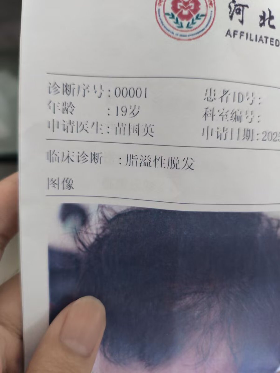 我秃了我秃了我秃了😭😭😭
我再也不熬夜了我再也不熬夜了我再也不熬夜了😭😭😭