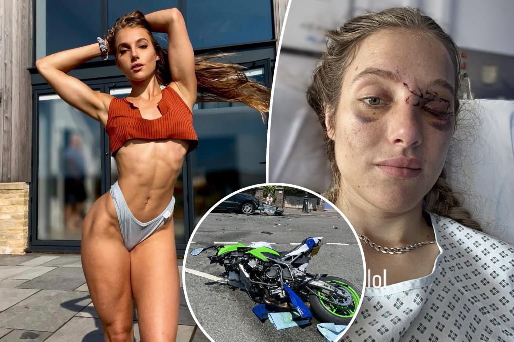 KnightClawk's tweet image. Death-defying neuroscientist turned OnlyFans model confronts life with memory loss — after brutal bike accident caused by a pigeon