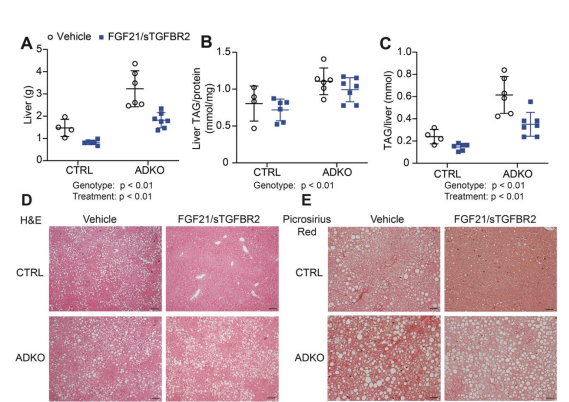 Congrats to <a href="/UMPhysiology/">UMPhysiology</a> PhD student <a href="/JessicaMaung/">Jess Maung</a> and the MacDougald lab for her paper in <a href="/JCI_insight/">JCI insight</a> showing metabolic dysfunction in lipodystrophy is improved by FGF21/sTGFBR2 gene therapy, but effectiveness depends upon environmental temperature. insight.jci.org/articles/view/…