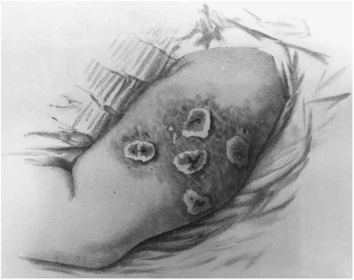 RBystrianyk's tweet image. What if everything you thought you knew about smallpox and vaccination was wrong? History tells a very different story—one of deadly experiments, failed promises, and a public that fought back. From Jenner’s shaky beginnings to the Leicester rebellion and beyond, the data reveals…