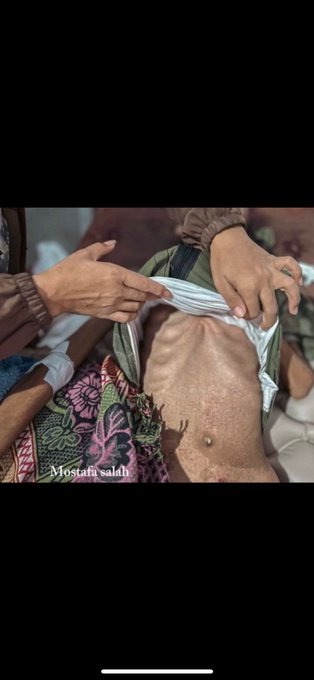 لو أن غزة دولة غربية، لأُعلنت المجاعة في نشرات الطوارئ، ولتدفقت الإغاثات من كل قارات الأرض

#غزة_المنسية #العدالة_العرجاء

#تمويل__عقاري__كاش