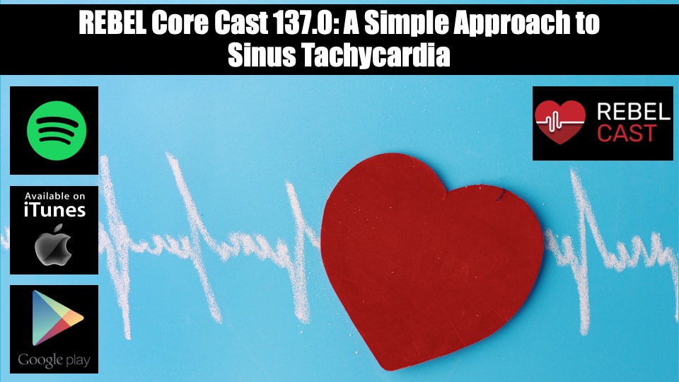 REBEL__EM's tweet image. 🫀 Sinus tachycardia = a sign, not a diagnosis.
Don’t just treat the rate—find the cause.
Use this 8-point checklist & skip reflexive beta blockers.
🎧 REBEL Core Cast 137: wp.me/pdrP8b-5nI
#FOAMed #MedEd #MEdicine #CriticalCare @Marco_Propersi @mramzydo
