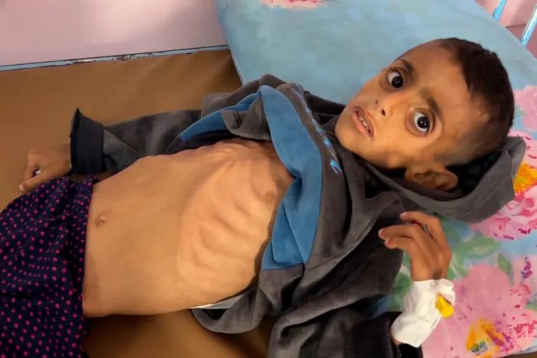 Nexo_Latino's tweet photo. 🚨 El hambre, arma de guerra del régimen sionista en #Gaza 🇵🇸

🔸La Franja de Gaza enfrenta una crisis humanitaria sin precedentes: miles de muertos y heridos por el hambre bajo un asedio que impide el acceso a alimentos básicos.

#GazaStarving 
#IsraeliCrimes https://t.co/05cYKZU2PW