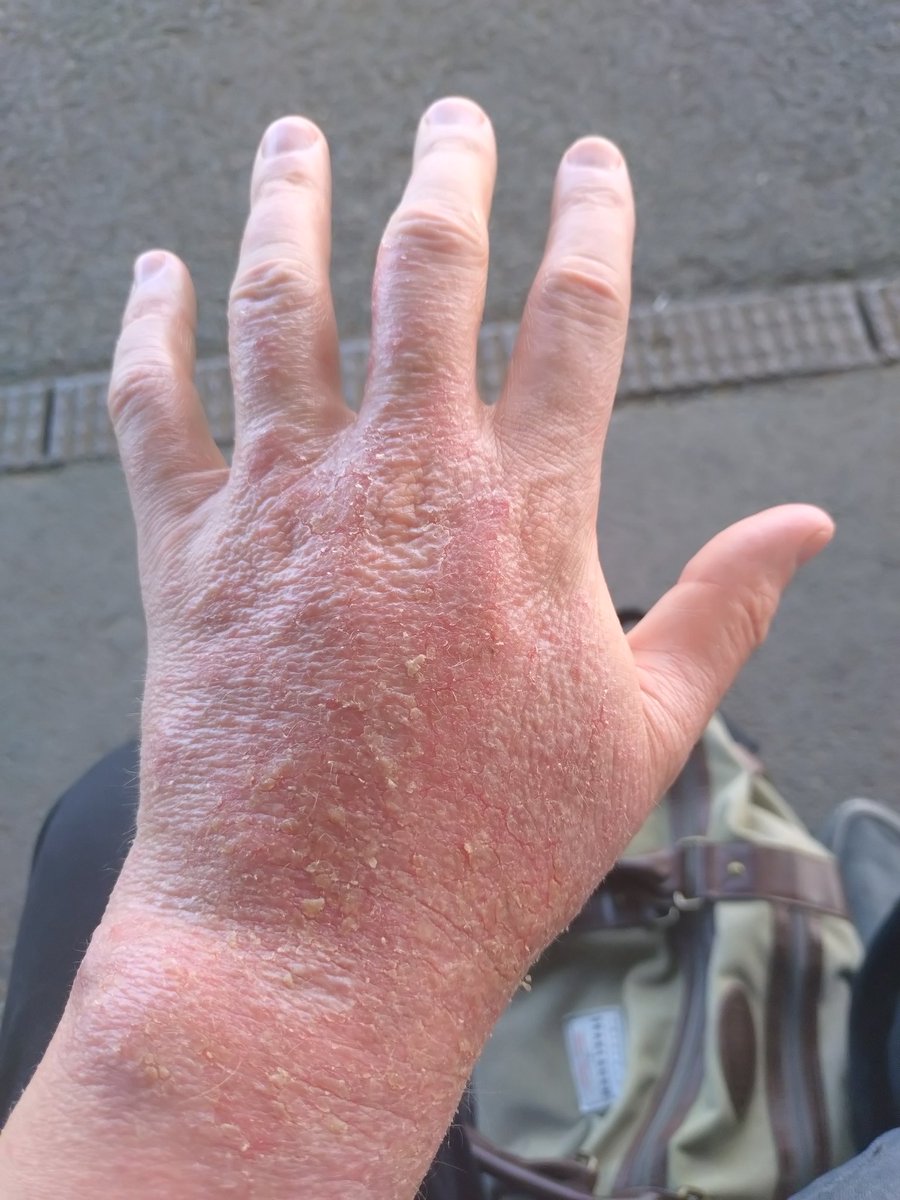 Ben Cartlidge tweet media