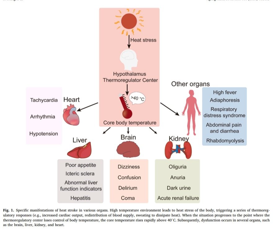 Golpe de Calor 🥵 🌡️ 

📖Definición
📊Epidemiología
🧬Fisiopatología
🤔Abordaje Diagnóstico
💉Tratamiento

🔰📚Ageing Research Reviews 2024

doi.org/10.1016/j.arr.…

Enlace a Artículo Completo 👇🏼✅🆓t.me/SoMELaguna