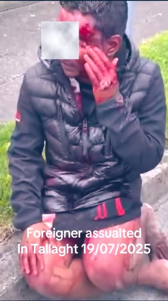 Akhilesh Mishra, Indian Ambassador to Ireland (@akhileshifs) on Twitter photo How can an “ALLEGED” assault cause such horrible injury & bleeding? Aghast at the insensitivity & obfuscation of <a href="/rte/">RTÉ</a> <a href="/rtenews/">RTÉ News</a>!
Thank Hon <a href="/paulmurphy_TD/">Paul Murphy 🇵🇸</a> <a href="/gardainfo/">Garda Info</a> & Irish people for their sympathy, support to the #innocent #victim. Hope the perpetrators are brought to #justice! How can an “ALLEGED” assault cause such horrible injury & bleeding? Aghast at the insensitivity & obfuscation of <a href="/rte/">RTÉ</a> <a href="/rtenews/">RTÉ News</a>!
Thank Hon <a href="/paulmurphy_TD/">Paul Murphy 🇵🇸</a> <a href="/gardainfo/">Garda Info</a> & Irish people for their sympathy, support to the #innocent #victim. Hope the perpetrators are brought to #justice!