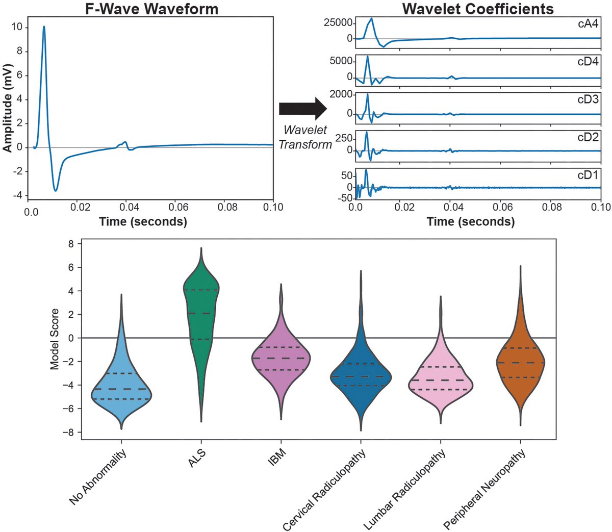 Brain1878's tweet image. Martinez-Thompson et al. show that AI approaches applied to clinical electromyography data can assist in diagnosing ALS and estimating patient survival. tinyurl.com/yc5j393h