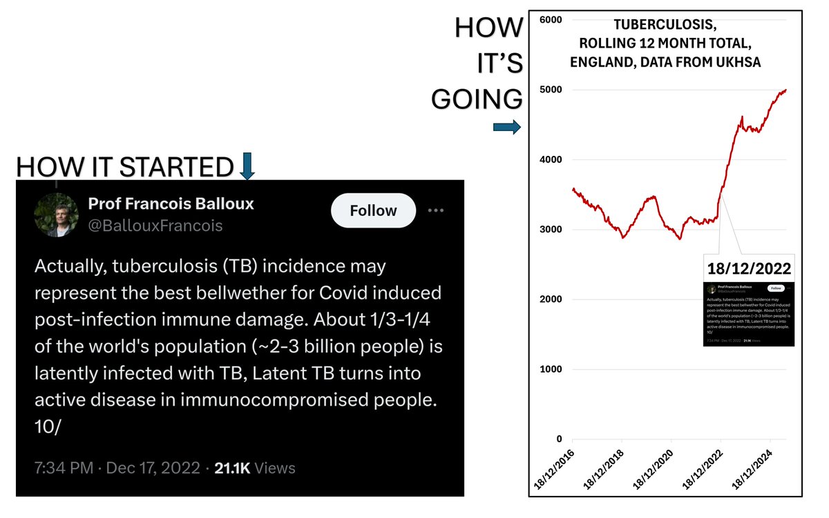 🚨
Do you remember when this dingdong said that TB incidence would make the best bellwether for Covid induced post-infection immune damage, back in 2022?

Look what has happened since then.

Like the man says: **"Latent TB turns into active disease in immunocompromised people"**