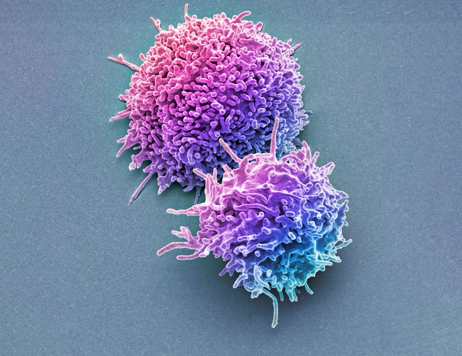 Science Immunology (@sciimmunology) on Twitter photo Tissue environment and viral specificity fine tune #cytotoxic capabilities of memory CD8 #TCells in humans. <a href="/marcus_buggert/">Marcus Buggert</a>
Learn more in Science #Immunology: scim.ag/44UWVrG Tissue environment and viral specificity fine tune #cytotoxic capabilities of memory CD8 #TCells in humans. <a href="/marcus_buggert/">Marcus Buggert</a>
Learn more in Science #Immunology: scim.ag/44UWVrG