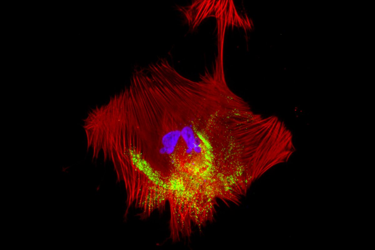 WhiteheadInst's tweet image. A smooth muscle cell is infected with SARS-CoV-2. By studying different cell types acting together, the Jaenisch lab shows that SARS-CoV-2 affects vascular cells indirectly, by infecting neighboring cells: wi.mit.edu/news/biology-i… #WhiteheadWonders