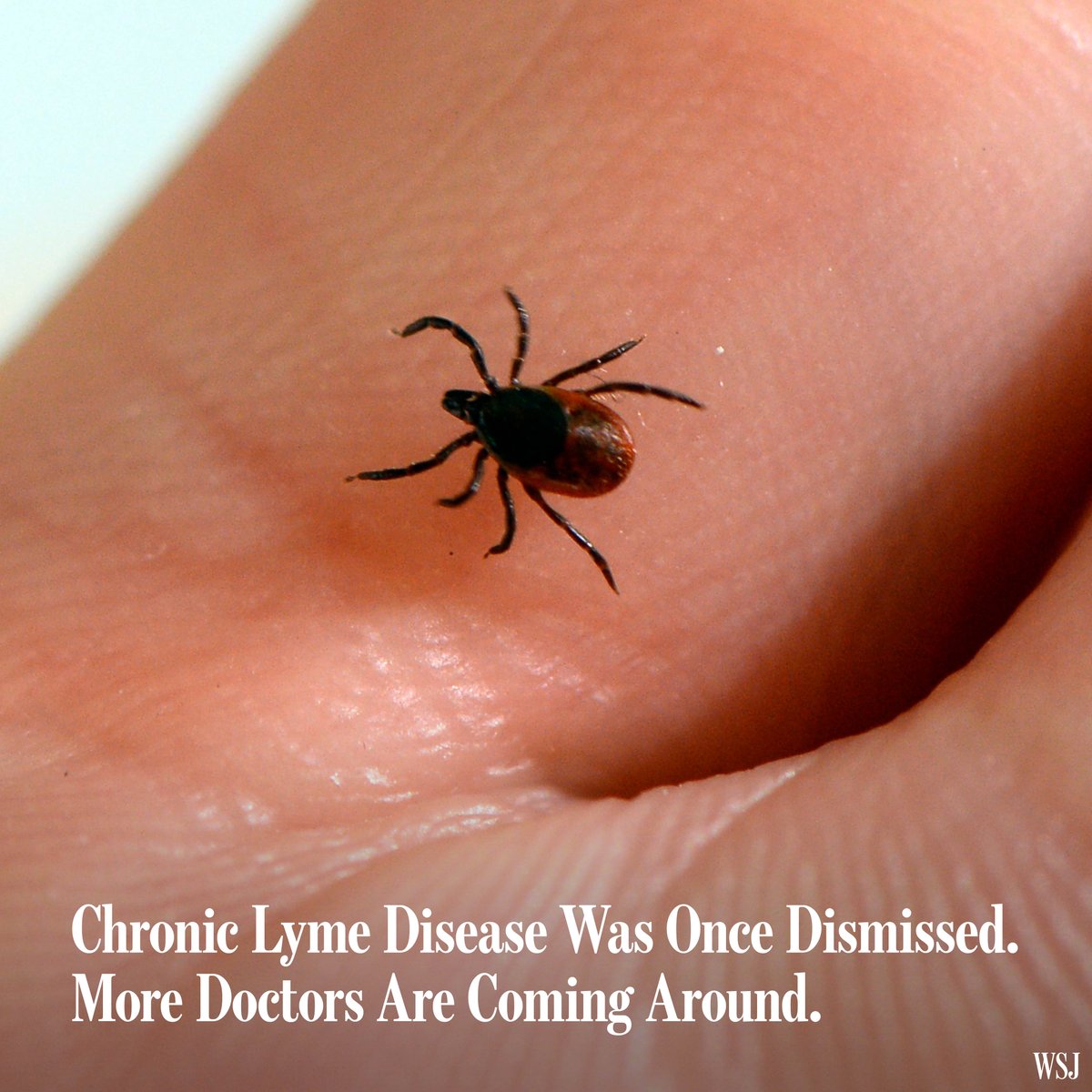 Chronic Lyme disease, long-contentious, is becoming more mainstream in medicine, after Covid-19 showcased how an infection can leave people with lingering symptoms. 🔗 on.wsj.com/3IykXkN