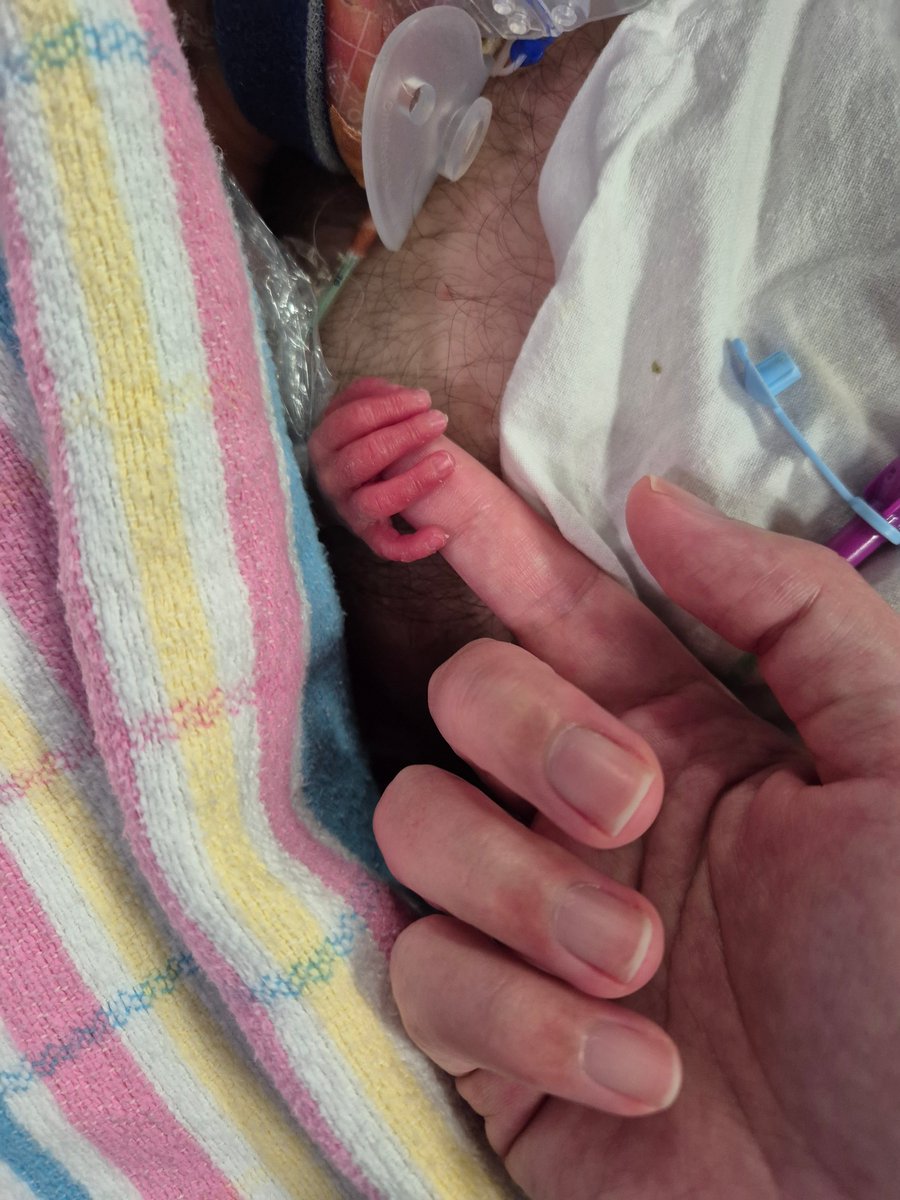 We would like to introduce our baby boy, Theodore, to the world! 

Delivered at just 24 weeks, he arrived 3.5 months early due to complications with Dot’s pregnancy. 

Thankfully, both Mum <a href="/dorothydottydot/">dot</a> and Theo are recovering and doing well now.