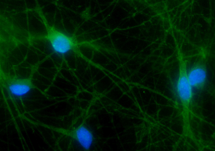 broadinstitute's tweet image. Partnership between @davidrliu, @jacksonlab, and rare disease group @RAREH0pe leads to first use of prime editing for a brain disease that reduced symptoms, extended lifespan in mice, offering hope for other rare genetic diseases. broad.io/Prime-AHC