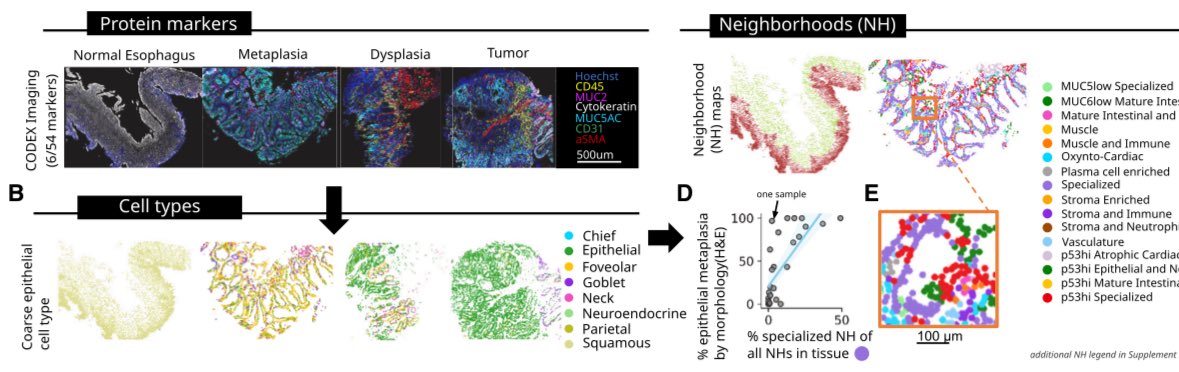 LFerri123's tweet image. So excited to see this paper on the stromal changes driving Barrett’s Esophagus progression to Cancer. A Herculean effort effort integrating scRNASeq/CODEX/ECM proteomics.
Concerted changes in Epithelium and Stroma: a multi-scale, multi-omics... sciencedirect.com/science/articl…