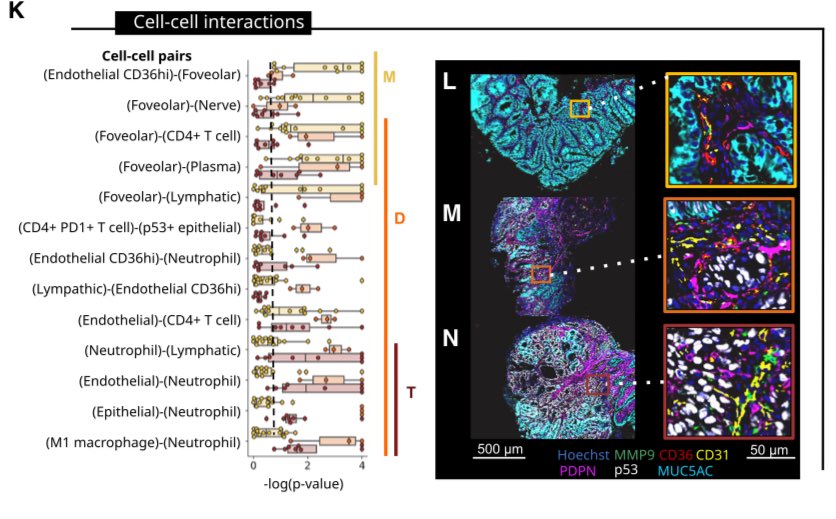 LFerri123's tweet image. So excited to see this paper on the stromal changes driving Barrett’s Esophagus progression to Cancer. A Herculean effort effort integrating scRNASeq/CODEX/ECM proteomics.
Concerted changes in Epithelium and Stroma: a multi-scale, multi-omics... sciencedirect.com/science/articl…