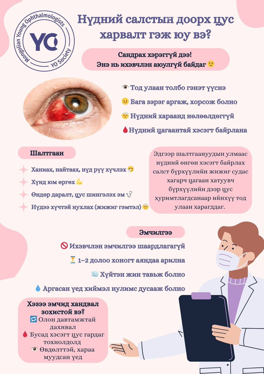 BoldmaaGanbold's tweet image. Салстын доорх цус харвалт нь нүдний цагаан хэсэгт гэнэт үүсдэг өвдөлтгүй улаан толбо ба салстын жижиг судас хагарсантай холбоотой.
Энэ нь нүдний хараанд нөлөөлдөггүй ба бага зэрэг цочирсон үед аргах,хорсох мэдрэмж төрдөг. Харин нэмэлт зовуурь илэрвэл нүдний эмчид хандах хэрэгтэй.