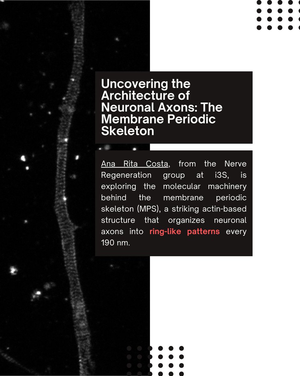 PPBioImaging's tweet image. Meet Ana Rita Costa! Ana Rita studies the membrane periodic skeleton (MPS), the so-called actin rings, in axons spaced ~190 nm apart. With STED microscopy, she reveals how nanoscale structure shapes neuron function. 🔬🧠 #Neuro #STED #MPS #Actinrings