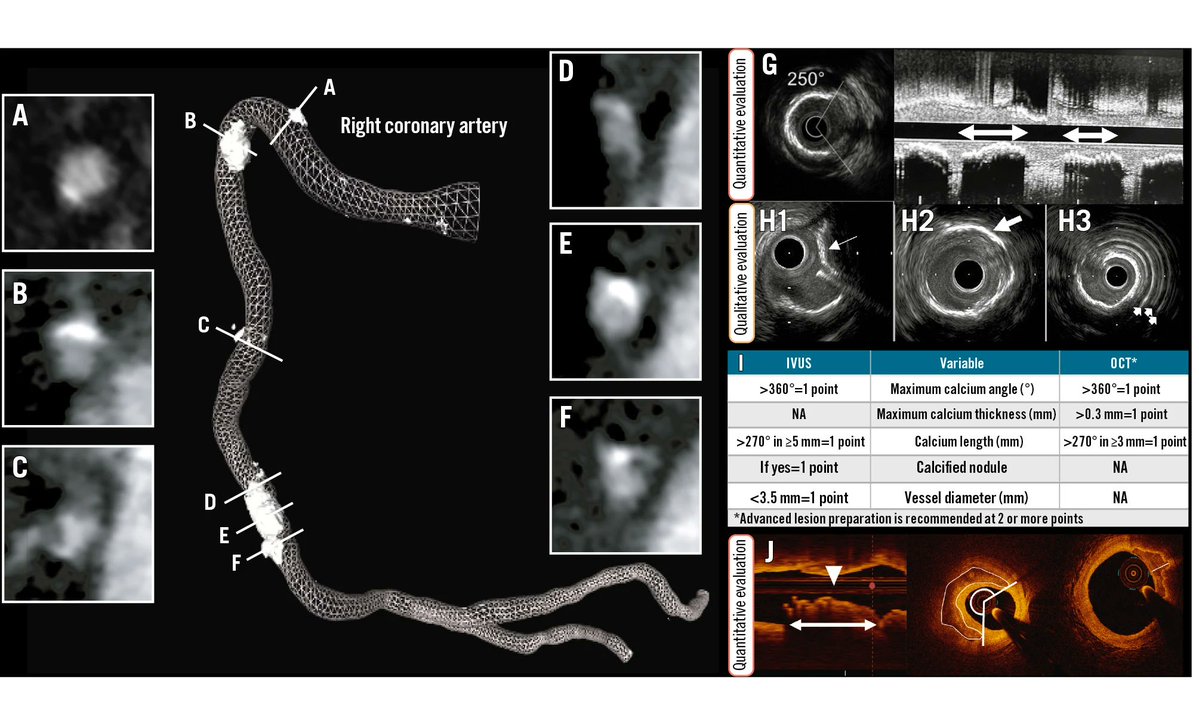 This State-of-the-Art review aims to facilitate a comprehensive assessment of plaque pathology using coronary imaging. It outlines how imaging characterizes plaque components and phenotypes, links plaque features to clinical events, and summarizes trials using serial imaging to