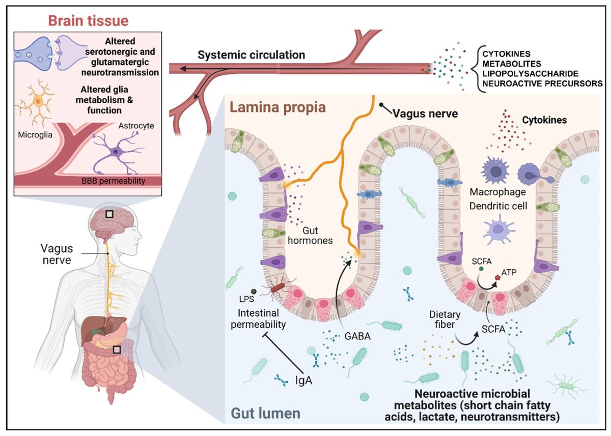 Modulación prebiótica y probiótica de la microbiota intestinal en la depresión 🧠
🔹 Nervio vago: canal directo de comunicación entre intestino y cerebro.
🔹 Sistema inmune: una microbiota disfuncional puede generar inflamación crónica.
🔹 Metabolitos microbianos: como el