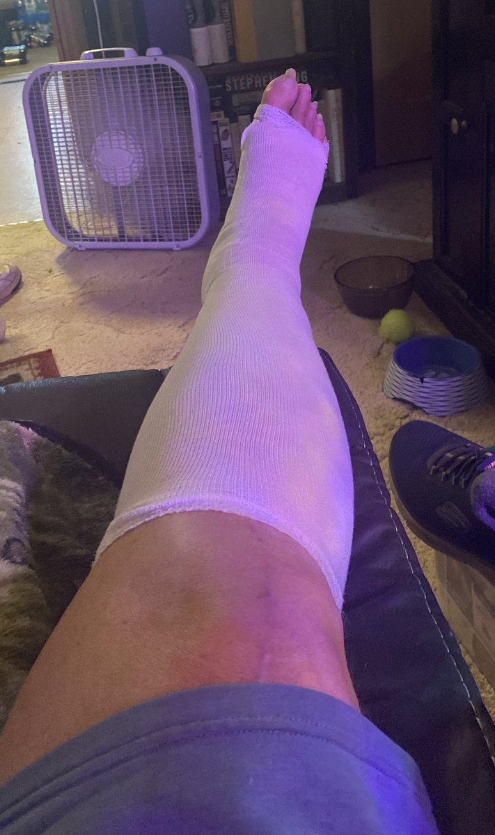 I had a sore on my leg that would healed, I went to wound Doctor, he heavy medicated it and then wrapped it with 4 different gauzes, I have to keep it elevated. I go back to Doctor on Friday, I hoped I get a good report.

I am bored I appreciate any and all pictures and videos