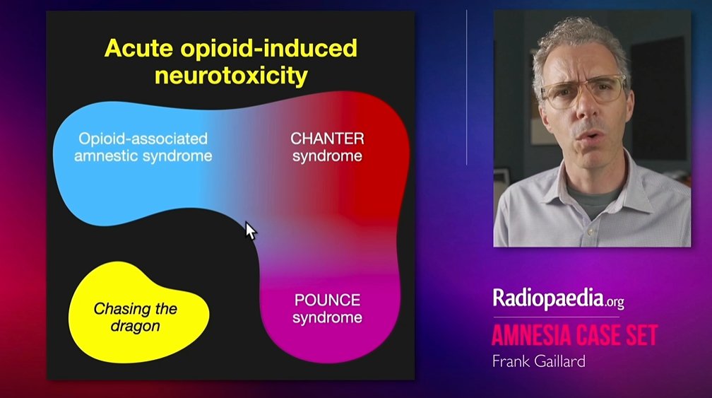 francisdeng's tweet image. Opioid-induced neurotoxicity has a spectrum of neuroradiologic manifestations. Are you familiar with these?
@FrankGaillard at @Radiopaedia Day 1 (supraclavicular radiology)