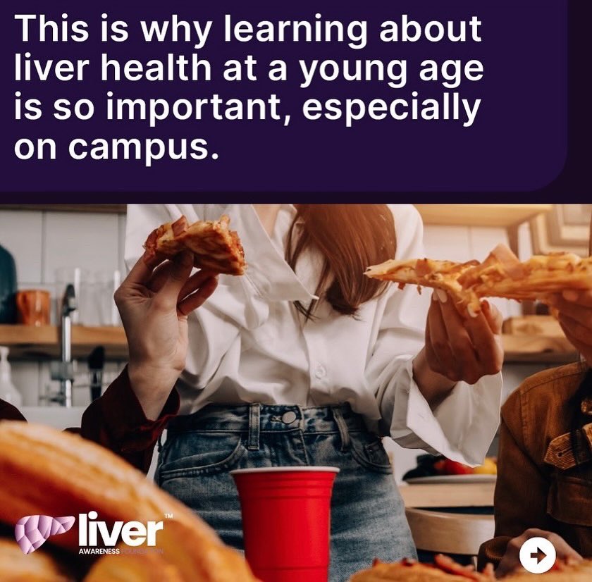 LiverAwareness's tweet image. It’s #NationalJunkFoodDay and student life means late nights and all kinds of random meals. Most students don’t realize liver health starts now, not later.
👉 Check out our new Students page and take the quiz at
liverawareness.org/students
#LiverAwareness #MindYourLiver #Students