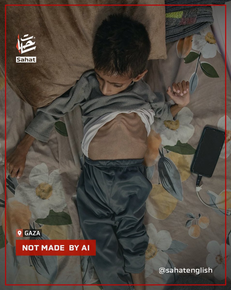 sahatenglish's tweet image. Hunger is killing children and adults alike in Gaza.The continued closure of border crossings and the ongoing war of extermination have created a humanitarian catastrophe. #Famine_in_Gaza