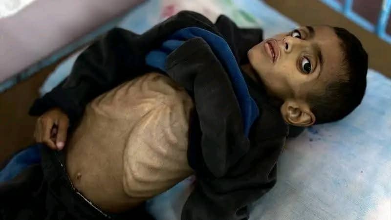 AboAsam52's tweet image. ابناء غــــ،ـــــزة يمـ،ــوتون من الجـــ،ــــوع وملياري مسلم يتفرجون بصمت مخـــ،ـــزي وصدق الذي قال هل الجـــ،ــوع كافــ،ــــر ام المسلمين كفـــ،ــــروا حسبنا الله ونعم الوكيل فيكم.
#غزه_تموت_جوعاً
#Gaza_meurt_de_faim