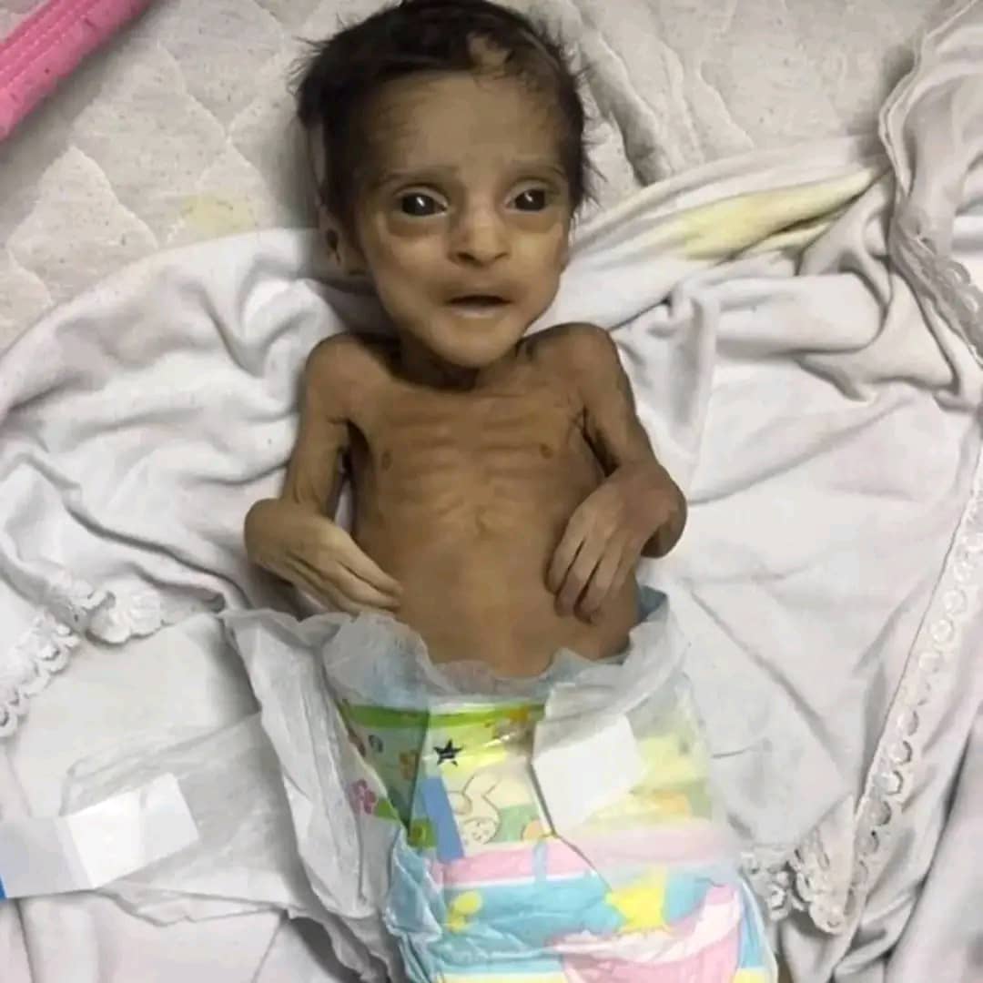 AboAsam52's tweet image. ابناء غــــ،ـــــزة يمـ،ــوتون من الجـــ،ــــوع وملياري مسلم يتفرجون بصمت مخـــ،ـــزي وصدق الذي قال هل الجـــ،ــوع كافــ،ــــر ام المسلمين كفـــ،ــــروا حسبنا الله ونعم الوكيل فيكم.
#غزه_تموت_جوعاً
#Gaza_meurt_de_faim